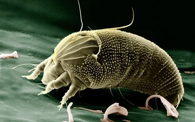 Image result for dust mites actual size