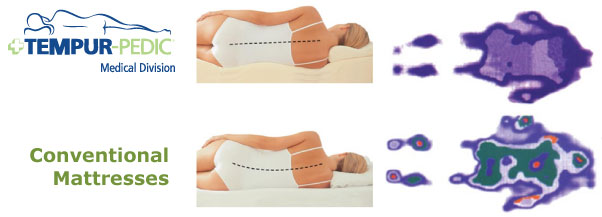 Tempur-Pedic� Pressure Management