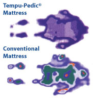 Tempur-Pedic® Mattresses vs. Conventional Inner Spring Mattresses