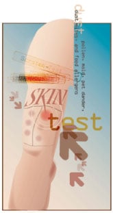 Allergy Skin Test