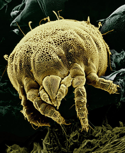 Dust Mites Under a Microscope - The Most Common Allergy & Asthma 