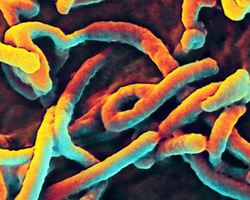 Halloween is Almost Here, but This Is NOT Gummy Worms - The Ebola Virus Under a Microscope