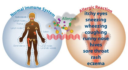 Introduction to Allergies