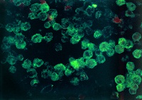 Naegleria fowleri Under a Microscope