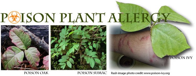 Toxicodendron Dermatitis: Poison Plant Allergy