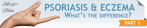 Differences Between Psoriasis and Eczema